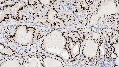 NKX2.1 antibody [SPT24]