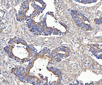 Anti-MCCC2 Antibody 抗体，orb1786