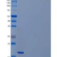 人血小板衍生生长因子BB/PDGF-BB重组蛋白