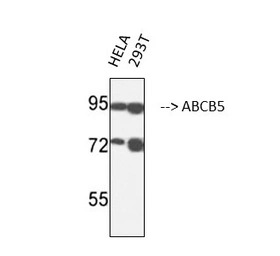 ABCB5 antibody [11A2]