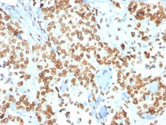 Emerin antibody [EMD/2167]