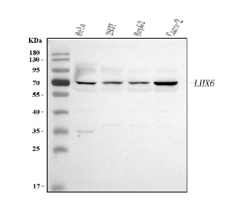 Anti-LHX6 Antibody 抗体，orb17860