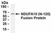 NDUFA10 Antibody 抗体，orb1253982