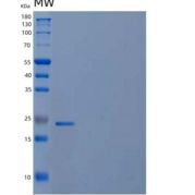 人磷酸甲羟戊酸激酶/PMVK重组蛋白N-6His