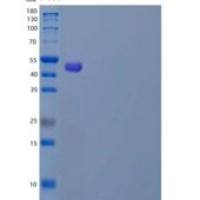 人自噬相关4同源物C/ATG4C重组蛋白C-6His