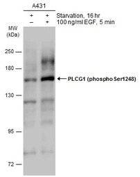PLCG1 (phospho Ser1248) antibo