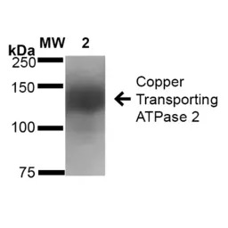 ATP7b antibody [S62-29]