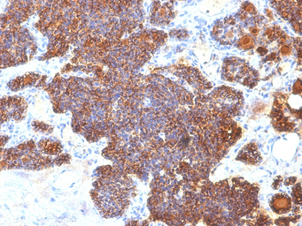 Parathyroid Hormone antibody [