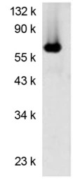Firefly Luciferase antibody [L