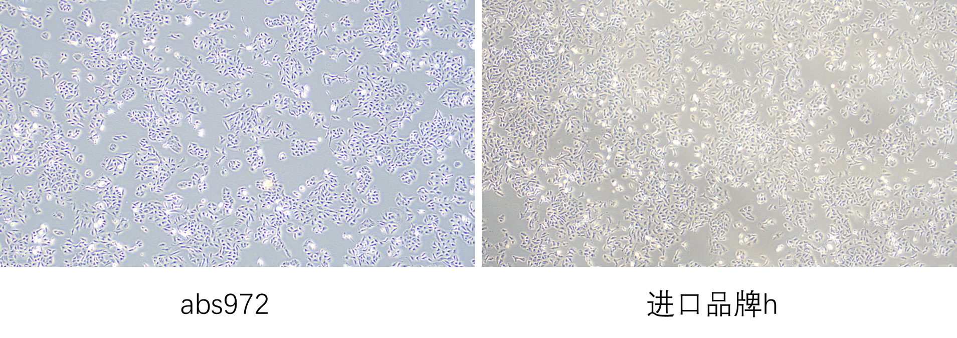 胎牛血清(优级); 优级胎牛血清; FBS