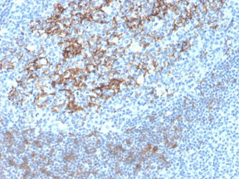 CD23 antibody [FCER2/4395R]