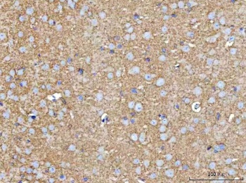 Anti-MOSPD2 Antibody 抗体，orb178