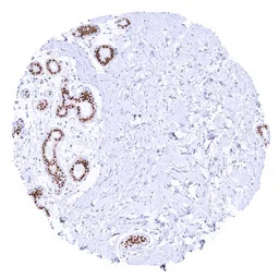 TRPS1 antibody [MSVA-512R] His