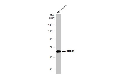 RPE65 antibody [HL1519]