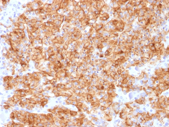 Chromogranin A antibody [CHGA/