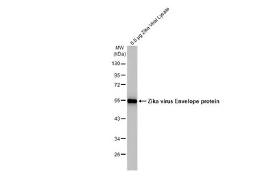Zika virus Envelope protein an