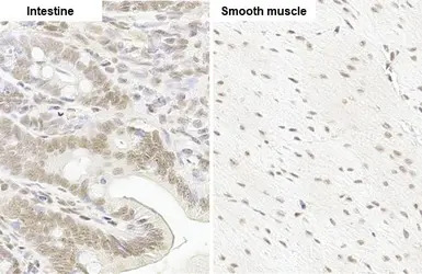 Glucocorticoid Receptor antibo