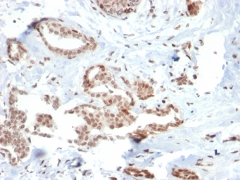 SOX4 antibody [SOX4/2540]