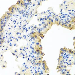 Ferrochelatase antibody