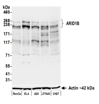 ARID1B Antibody 抗体，orb1806438，