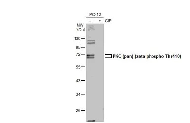 PKC (pan) (zeta phospho Thr410
