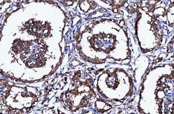 Anti-MCCC1 Antibody 抗体，orb1786