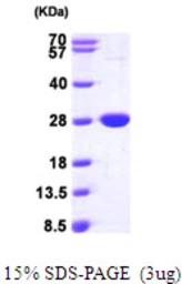 E. coli NFNB protein, His tag