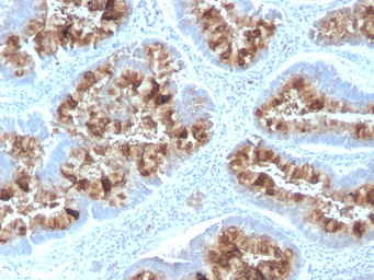 MUC1 antibody [MUC1/2818R]