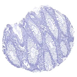 UPK1B antibody [MSVA-734M] His