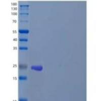 人三磷酸腺苷酶SWSAP1/SWSAP1重组蛋白N-6His
