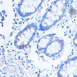 LRP130 antibody