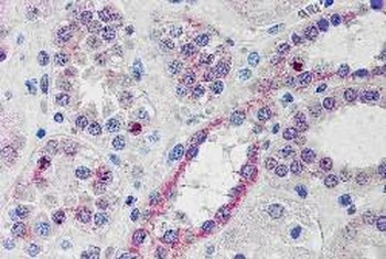 NOXO1 Antibody 抗体，orb1247189，B