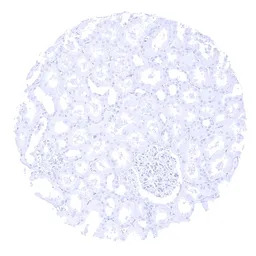 Parathyroid Hormone antibody [