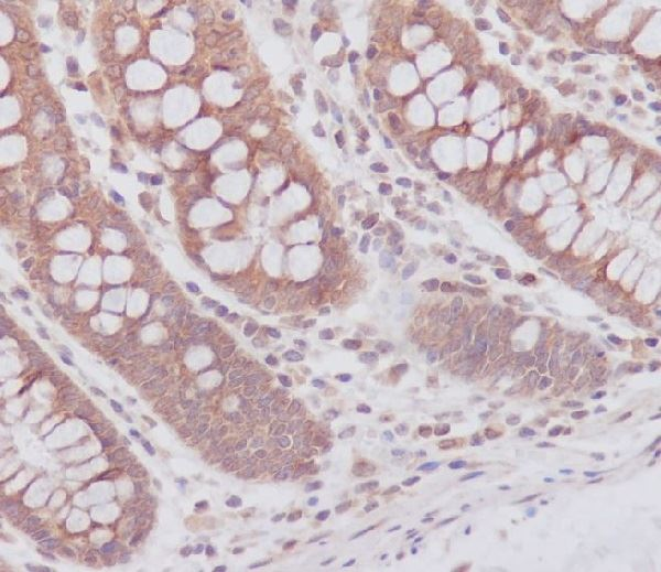 ATG7 Rabbit pAb 兔多克隆抗体