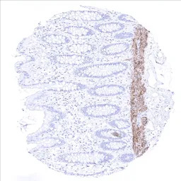 Calponin 1 antibody [MSVA-455R