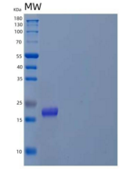 人前折叠蛋白亚基4(PFDN4)重组蛋白N-6His