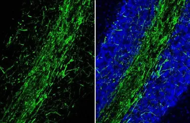 Myelin basic protein antibody 
