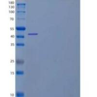 人成釉蛋白/AMBN重组蛋白C-6His