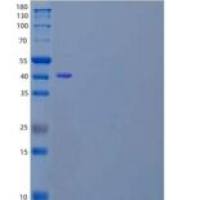人α-Parvin/PARVA/MXRA2重组蛋白C-6His