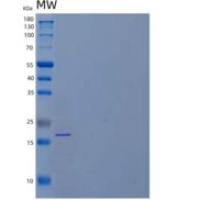 人白介素33(IL33)重组蛋白N-6His