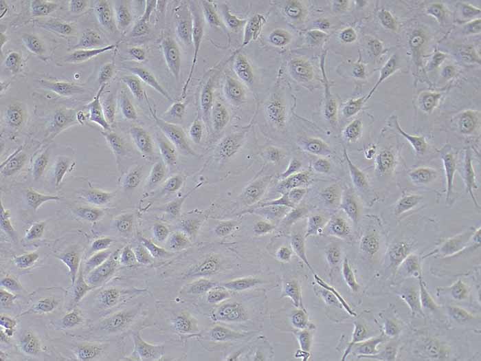 人脐静脉内皮细胞HUVEC图片