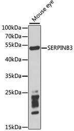 SerpinB3 antibody