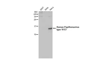 Human Papillomavirus type 18 E
