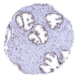Androgen Receptor antibody [MS