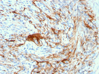Elastin antibody [ELN/3131R]