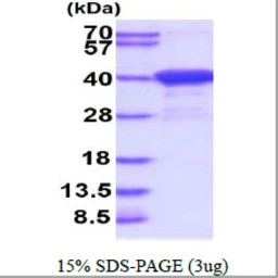 Human Aspartoacylase protein, 