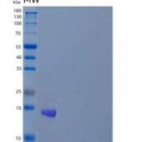 人锌指蛋白75A/ZNF75A重组蛋白N-6His