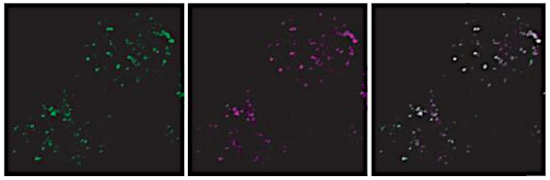 Immunofluorescence using anti-VPS35 antibodies