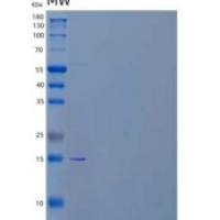 人锌指蛋白100(ZNF100)重组蛋白N-6His