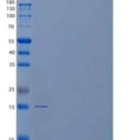 人α-乳白蛋白/乳酸菌重组蛋白C-6His